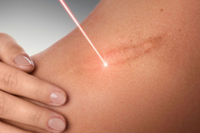 The Most Effective Dermatologist Treatments for your Skin