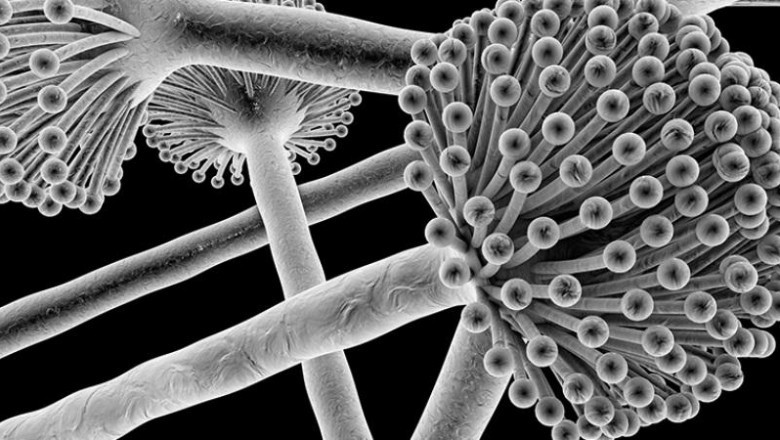 Aspergillosis Treatment Tests to pinpoint the cause of human symptoms