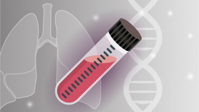 Liquid Biopsy Market Share, Growth, Statistics, by Application, Production, Revenue & Forecast
