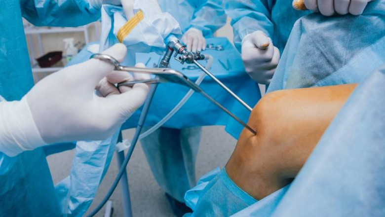 Best Arthroscopy Surgeon in Patna | Arthroscopy Surgery : Dr. Ashwini Gaurav