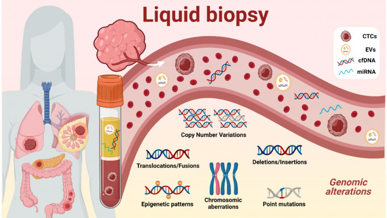 Liquid Biopsy Market Analysis, Regional Outlook, Business Landscape and Future Prospects 2026
