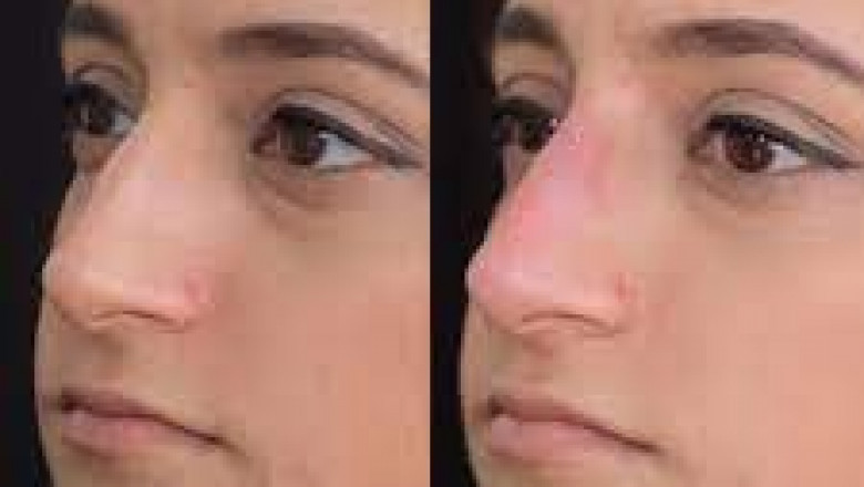 Pakistan best dermatologist