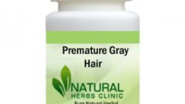 Herbal Treatment for Premature Gray Hair | Natural Remedies | Natural Herbs Clinic