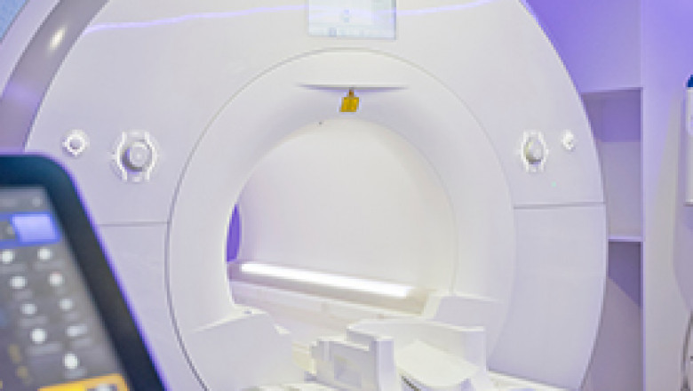 MRI Scan