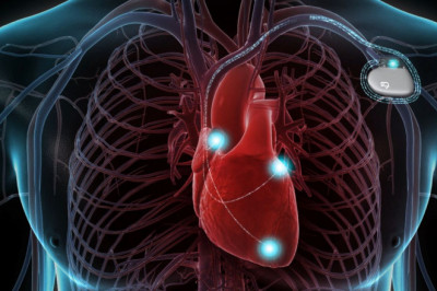 Implantable Cardioverter-defibrillators Market by Product Type, Patient Type , End Users, and Region - Global Forecast to 2026