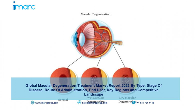Macular Degeneration Treatment Market Size, Share, Industry Growth, Trends, Analysis, Demand and Forecast by 2027