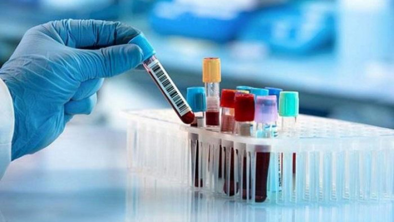 Cord Blood Banking Services Market Trends: Industry Analysis, Opportunity and Forecast to 2027