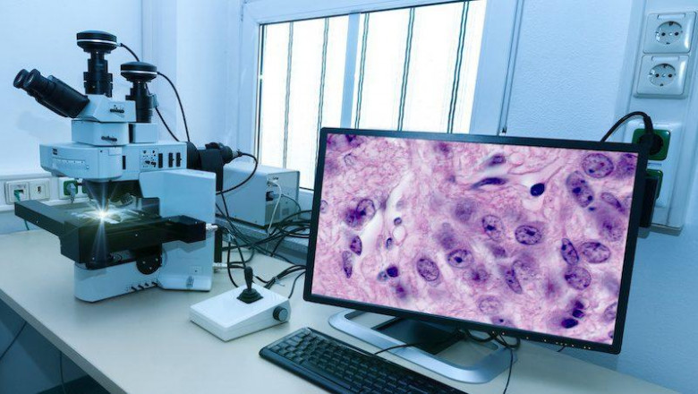 Digital Pathology Market Poised for Steady Growth in the Future 2021-2028