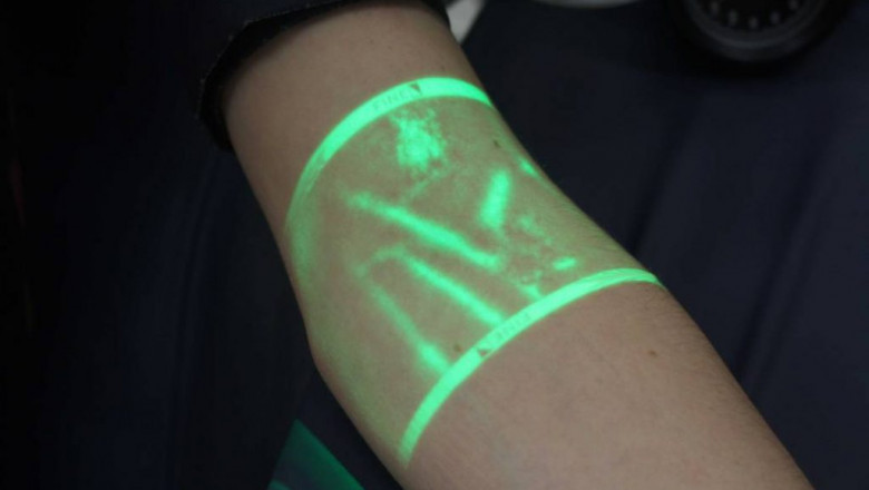 Vein illuminator Market Forecast - Global Industry Growth and Analysis – 2027