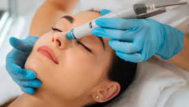 HydraFacial treatment in Lahore