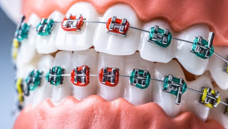 Do You Need the Help Of Orthodontists Open On Saturdays?