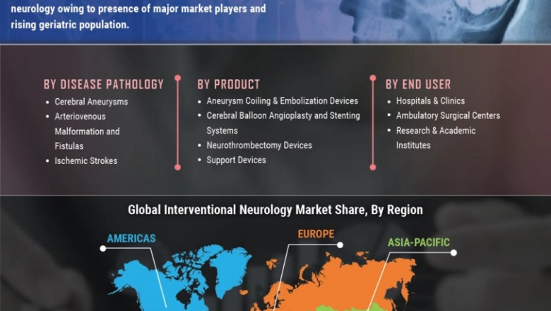 Interventional Neurology Market Status, Emerging Technologies, Future Plans and Trends by Forecast 2027