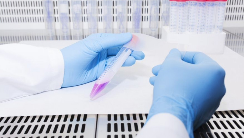 Pharmaceutical Processing Seals Market Size Estimation Research Report, 2022-2030