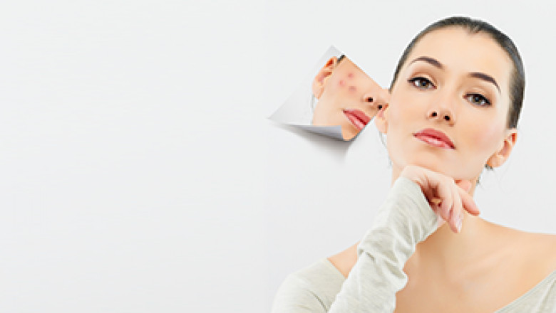 Acne Scar Treatment New York
