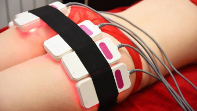 Lipo Laser Treatment Dissolves Fat