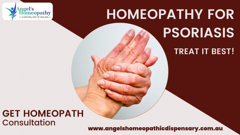 Homeopathic Remedies for Psoriasis - Angels Homeopathy