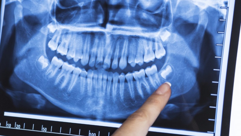 Dental Imaging Market : Features, Opportunities and Challenges forecast to 2029 | BIOLASE, Inc, Carestream Health, Danaher, DENTSPLY SIRONA