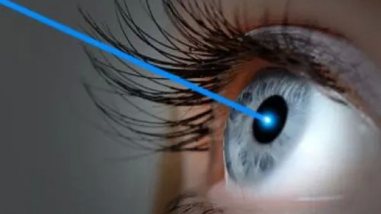 Contoura Vision Surgery