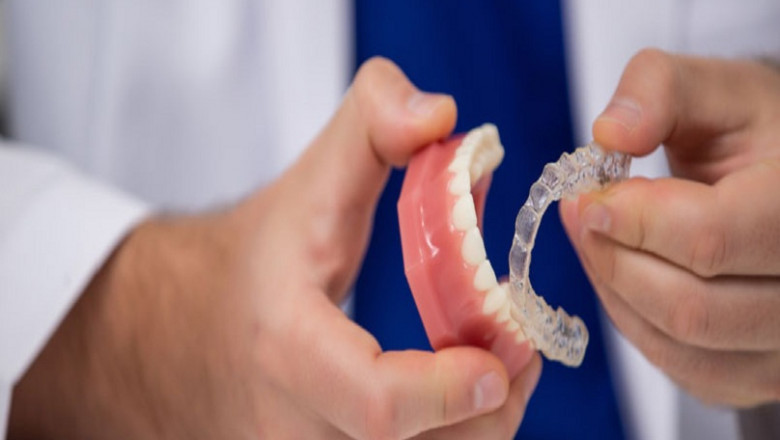What Are The Benefits Of Dental Implants?