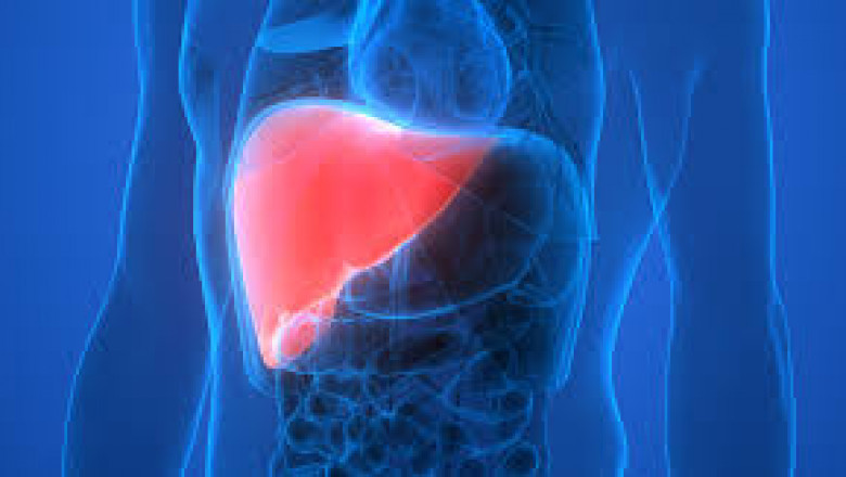 Liver Transplant Surgery Success Rate Cost and Procedure