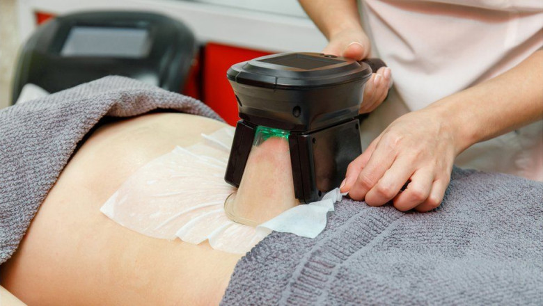 What is Fat Freezing?