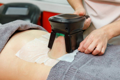 What is Fat Freezing?