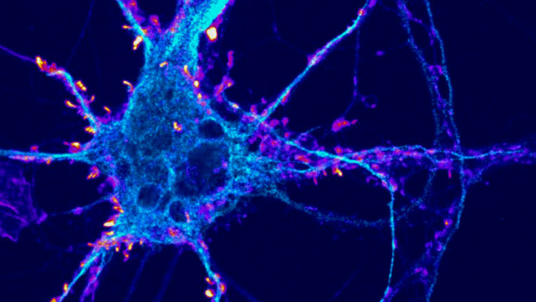 Immediate Treatment for Stress And Anxiety With Provided Psychedelic Drugs