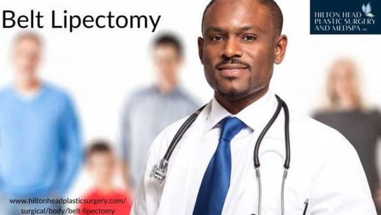 Get to know more about belt lipectomy
