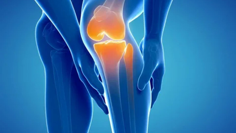 osteoarthritis Market Business Opportunities, Revenue 2022-2028| Research Informatic