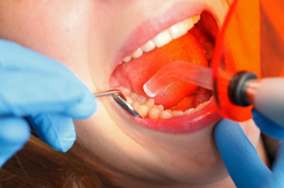 Restoration Dentist in 35115: How to Choose the Right One for You