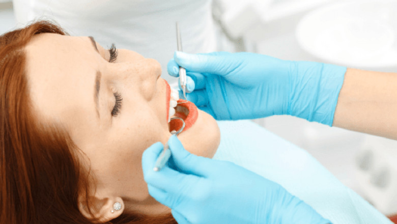 How Long Does A Root Canal Last?