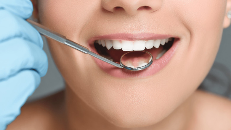 Is It Worth Getting Dental Implants?