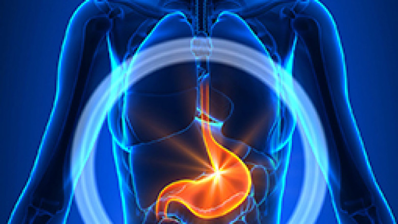 Stomach cancer treatment India