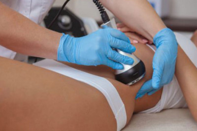 Ultrasonic Cavitation and Localized Fat Removal