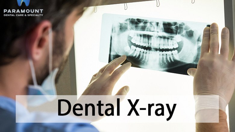 We Do Dental X-rays