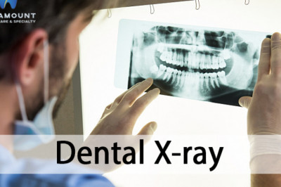 We Do Dental X-rays