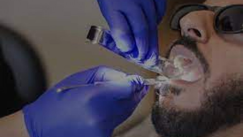 Why is Professional Teeth Cleaning Important?