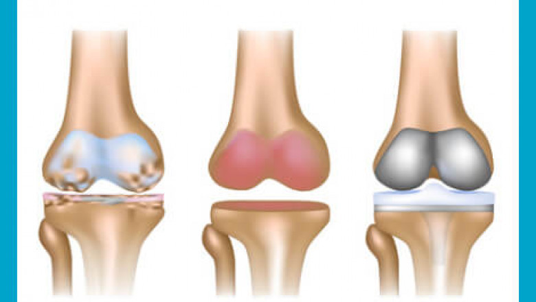 Surgeon specialized in arthroscopy and shoulder and knee prosthetics in Savona | drtradaortopedico bodoy