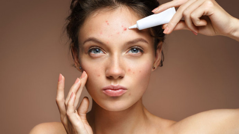 Black skin care: The top 5 tips