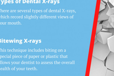 Do I Really Need X-Rays Every year? | Emergency Dental Service