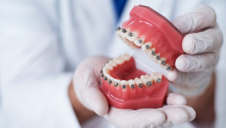 Top Reasons Your Child Should See a Child Dentist | Tower House Dental Clinic