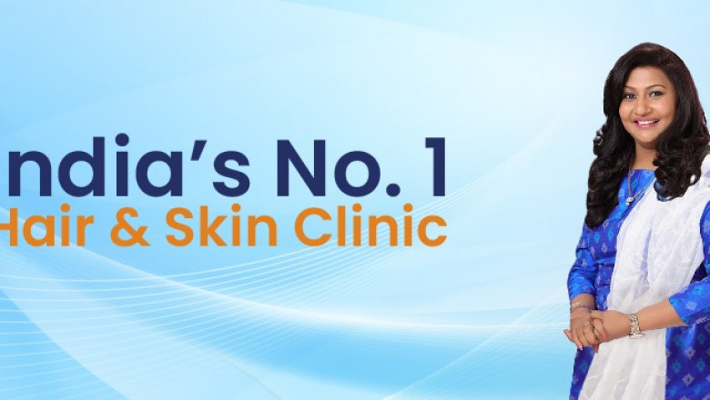 Why choose VCare Clinic to get Hair Loss Treatment in Chennai?