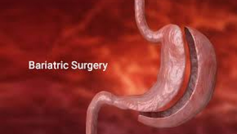 Medical Supplies Market Size, Share, Growth, Analysis, Trend, and Forecast Research Report by 2027