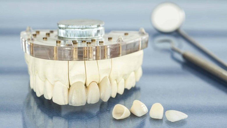 What Exactly Is A Cosmetic Dentist?