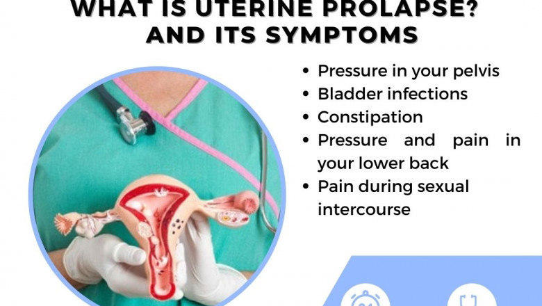 What is Uterine Prolapse? Symptoms and Causes! How is Uterine Prolapse Diagnosed? Explained Dr. Uday Thanawala