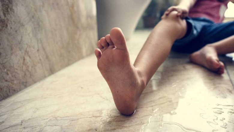 Bodily Injury Due to Slips And Falls - Florida