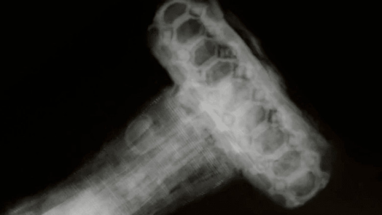 Heavily Decorated Viking Sword X-Rayed - ITS HISTORIA