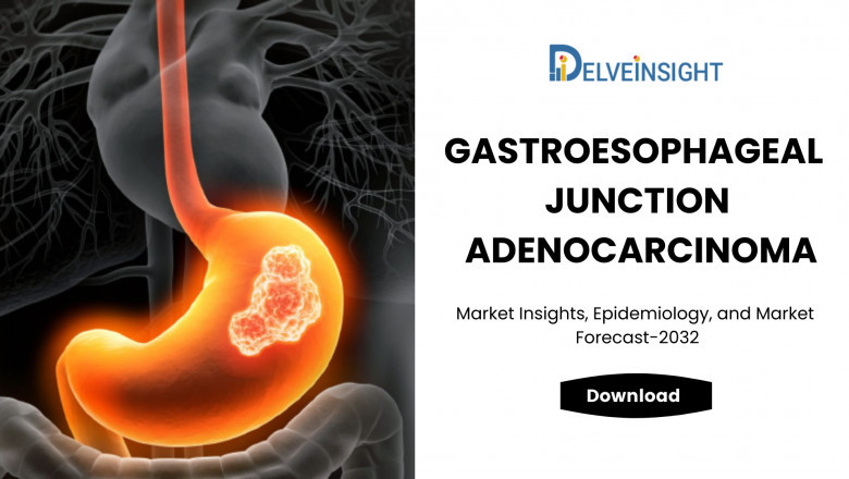 What is the Gastroesophageal Junction Adenocarcinoma Market Size?
