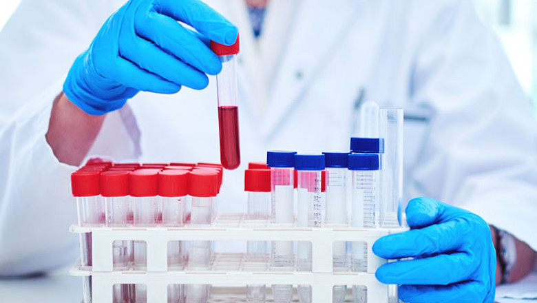 The Best Pathology Lab in Pimpri Chinchwad | Megavision Diagnostics Centres