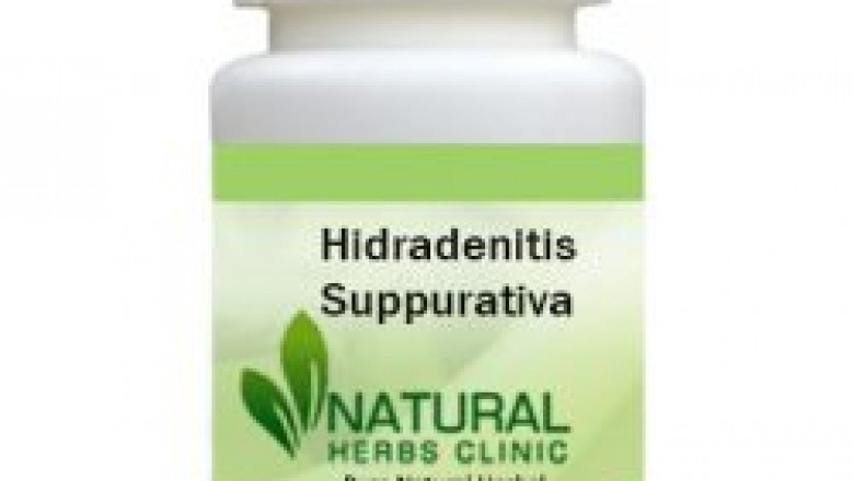 Herbal Treatment for Hidradenitis Suppurativa | Natural Remedies | Natural Herbs Clinic